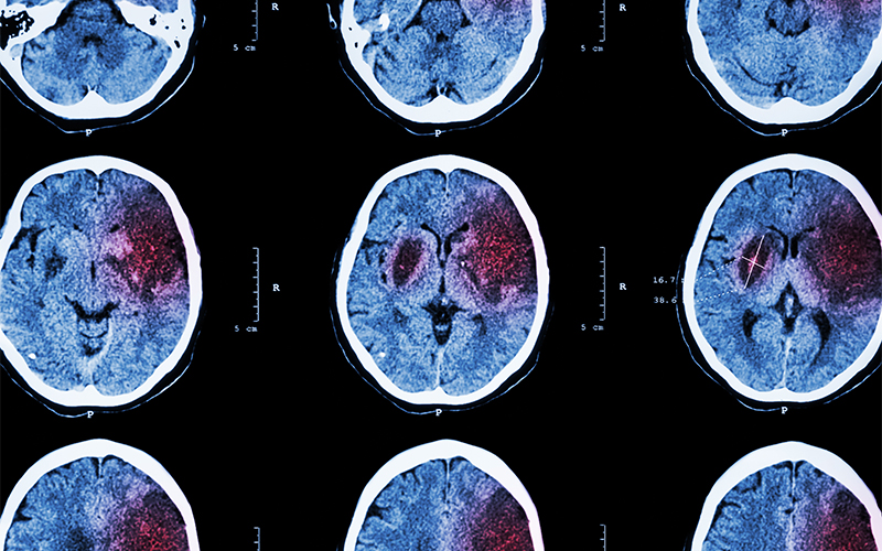 A set of nine brain scan images showing cross-sectional views of the brain. Some areas are highlighted in red, possibly indicating abnormalities or medical conditions. The images have measurement markings around the edges.