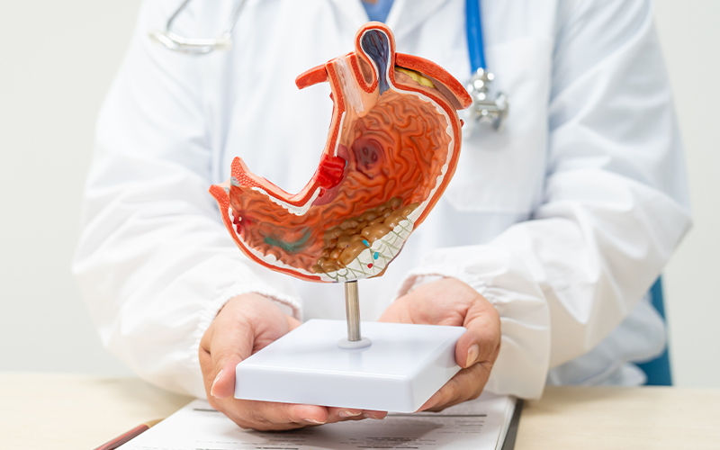 A doctor holds a model of a human stomach, illustrating the internal structure. The doctor wears a white coat and a stethoscope, sitting at a desk with a clipboard in the background.